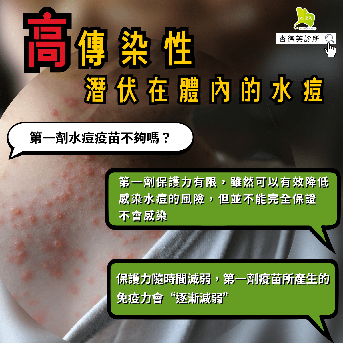水痘第二劑.png